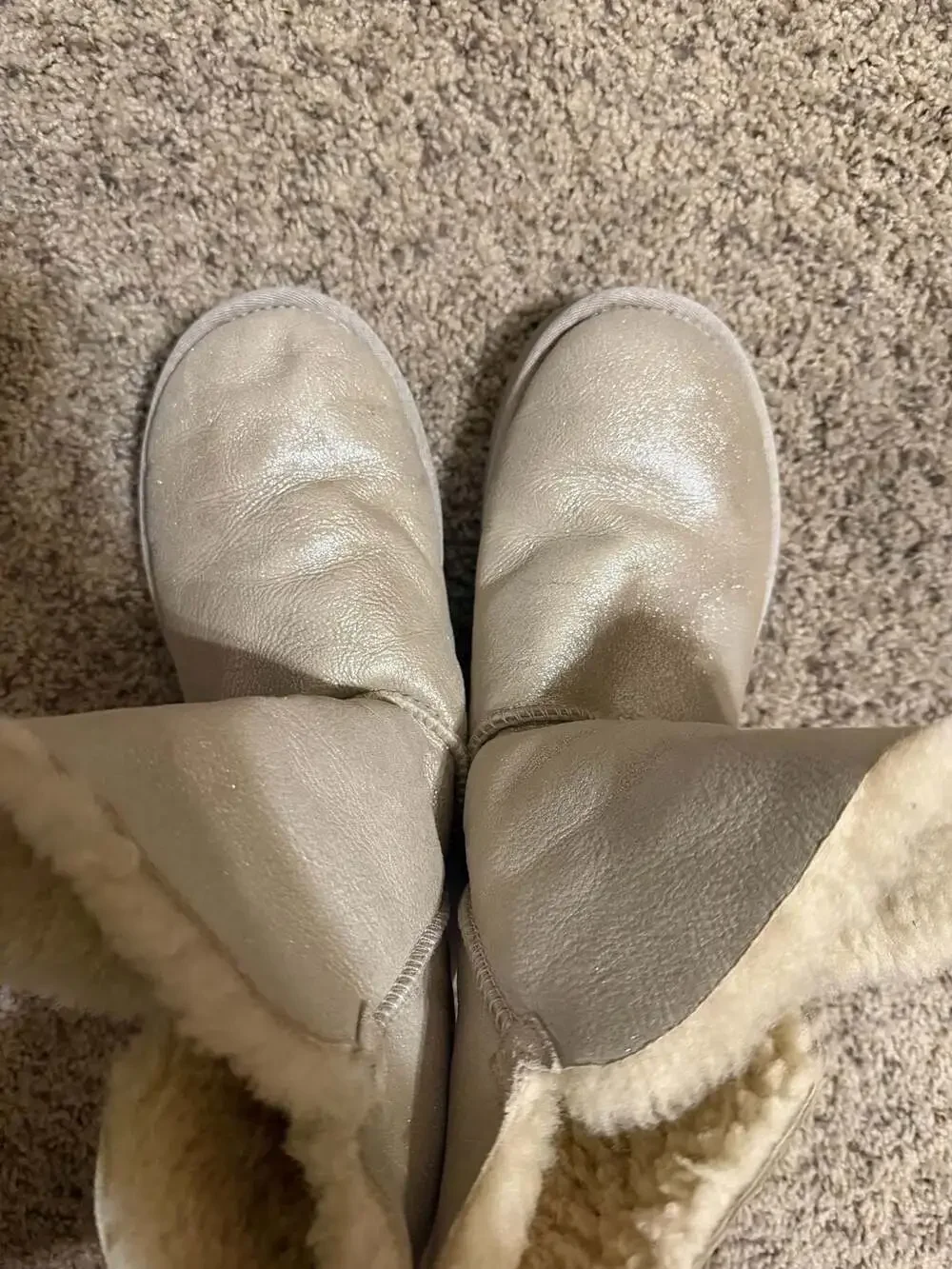 UGG Bailey Button Bling Metallic Gold Shearling Boots Size 7